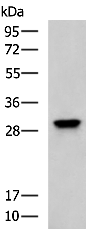 Rabbit Polyclonal Antibody to TMEM38B