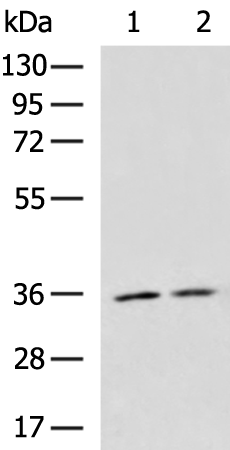 Rabbit Polyclonal Antibody to COPS6
