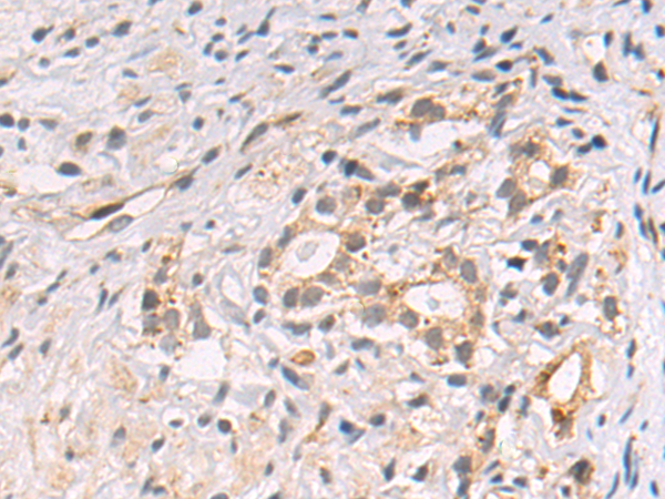 Rabbit Polyclonal Antibody to SIMC1