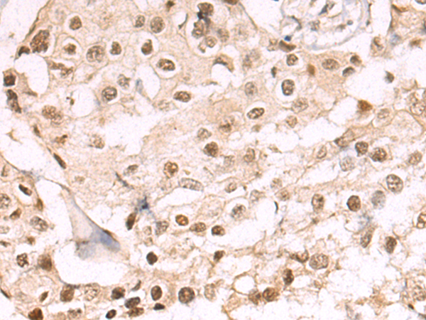 Rabbit Polyclonal Antibody to SS18L1
