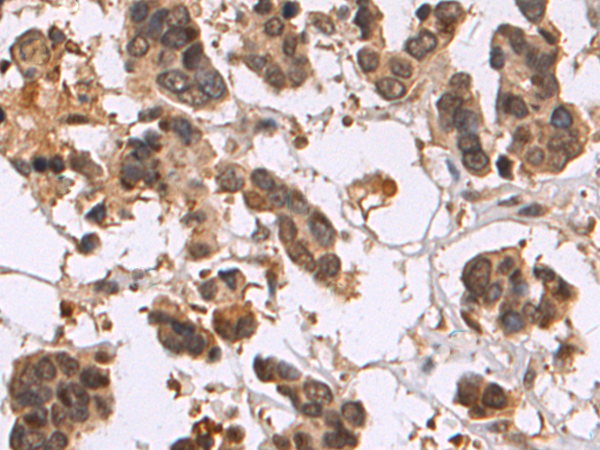 Rabbit Polyclonal Antibody to PHIP
