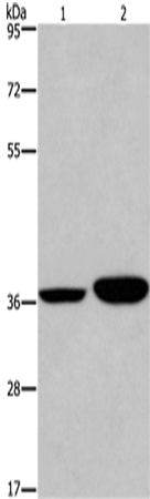 Rabbit Polyclonal Antibody to APAF1