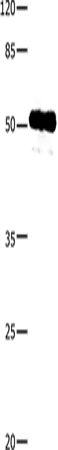 Rabbit Polyclonal Antibody to CASP10