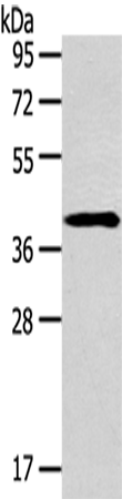 Rabbit Polyclonal Antibody to SERPINA3
