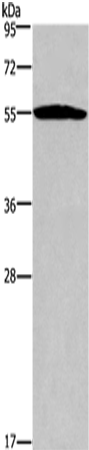 Rabbit Polyclonal Antibody to SERPINA1