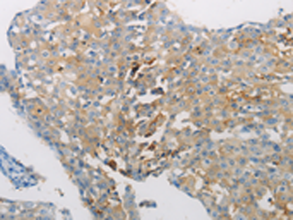 Rabbit Polyclonal Antibody to AATK
