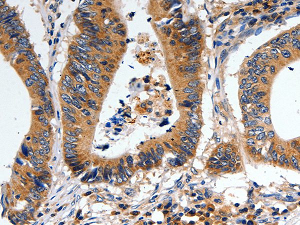 Rabbit Polyclonal Antibody to ABCB9