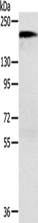 Rabbit Polyclonal Antibody to ACE