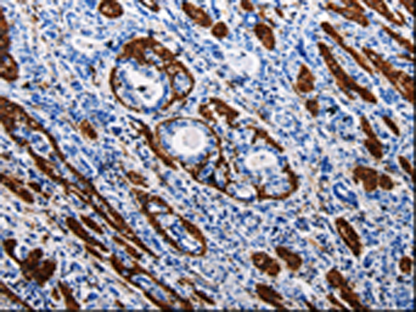 Rabbit Polyclonal Antibody to ACE2