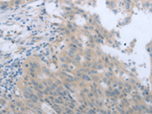 Rabbit Polyclonal Antibody to TNK2