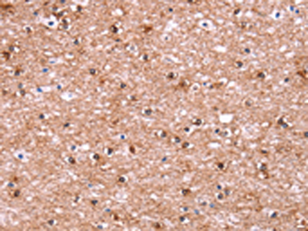 Rabbit Polyclonal Antibody to ADM2