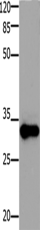 Rabbit Polyclonal Antibody to ADO