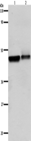 Rabbit Polyclonal Antibody to ADRB2