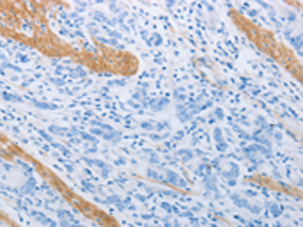 Rabbit Polyclonal Antibody to ADRB3