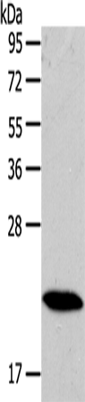 Rabbit Polyclonal Antibody to RAB18