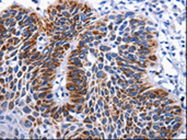 Rabbit Polyclonal Antibody to RAB25