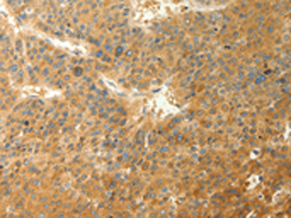 Rabbit Polyclonal Antibody to RAB35
