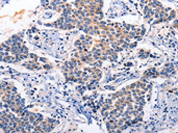 Rabbit Polyclonal Antibody to RAB39A