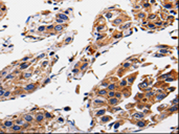 Rabbit Polyclonal Antibody to RAB41
