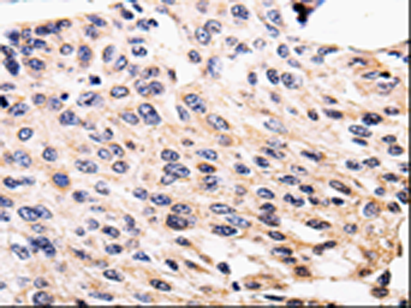 Rabbit Polyclonal Antibody to ALK