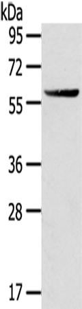 Rabbit Polyclonal Antibody to GPT