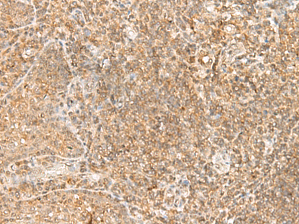 Rabbit Polyclonal Antibody to PRKAA1