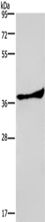 Rabbit Polyclonal Antibody to PRKAG1