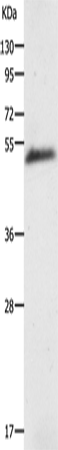 Rabbit Polyclonal Antibody to AGT