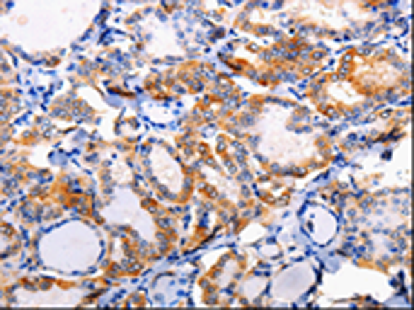Rabbit Polyclonal Antibody to AP1B1
