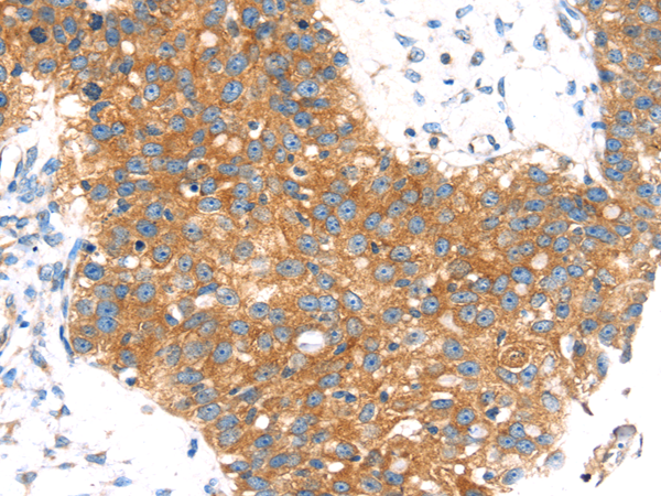 Rabbit Polyclonal Antibody to AP1G1