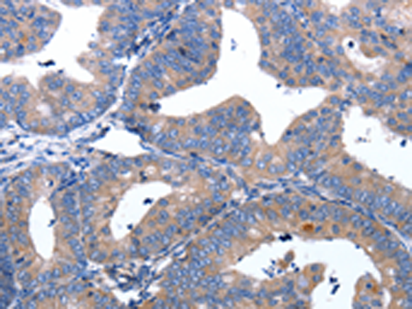 Rabbit Polyclonal Antibody to APAF1