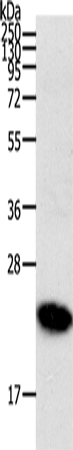 Rabbit Polyclonal Antibody to RHOC