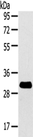 Rabbit Polyclonal Antibody to RALA