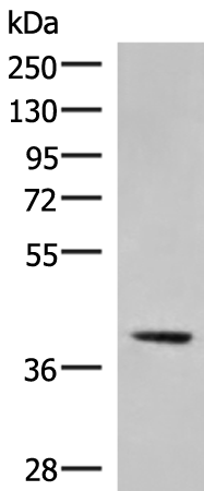 Rabbit Polyclonal Antibody to GNAZ