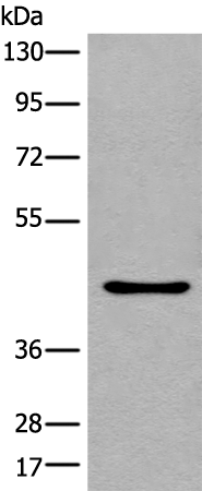 Rabbit Polyclonal Antibody to LOX