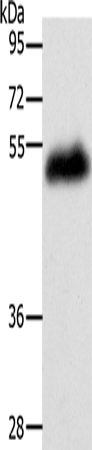 Rabbit Polyclonal Antibody to LOX