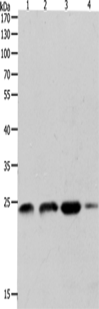 Rabbit Polyclonal Antibody to RHOA