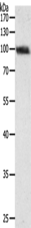 Rabbit Polyclonal Antibody to PYGB