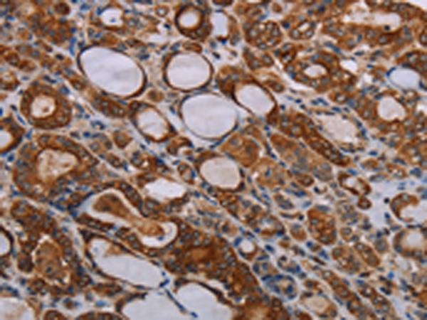Rabbit Polyclonal Antibody to FABP3