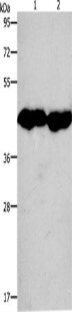 Rabbit Polyclonal Antibody to CKM