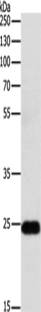 Rabbit Polyclonal Antibody to RALB