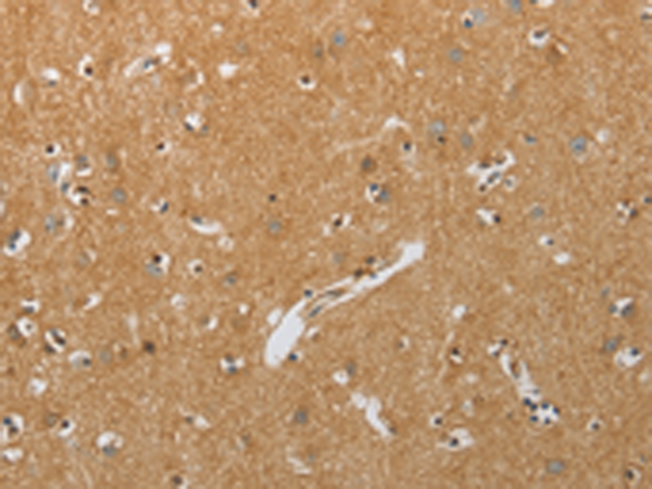 Rabbit Polyclonal Antibody to RHEB