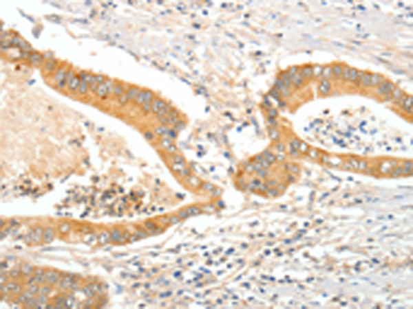 Rabbit Polyclonal Antibody to APOB