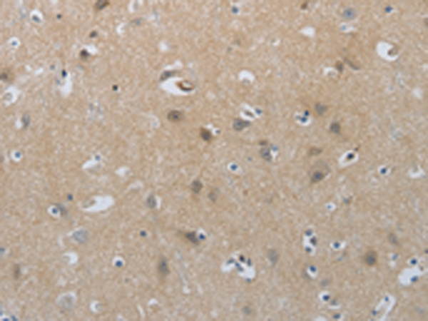 Rabbit Polyclonal Antibody to NPR1