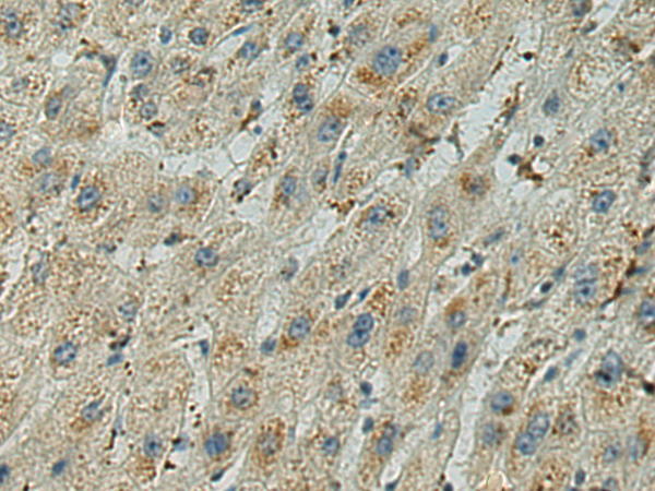 Rabbit Polyclonal Antibody to ADAMTS5