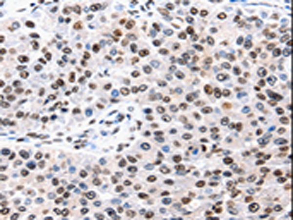 Rabbit Polyclonal Antibody to AQP2