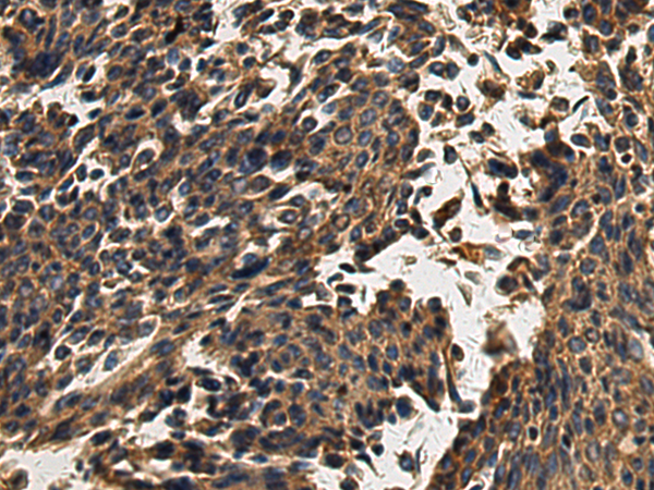 Rabbit Polyclonal Antibody to AQP5