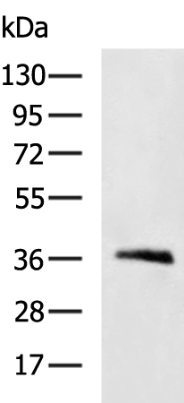 Rabbit Polyclonal Antibody to AQP3