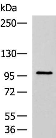 Rabbit Polyclonal Antibody to AR