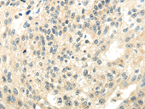 Rabbit Polyclonal Antibody to CYP19A1